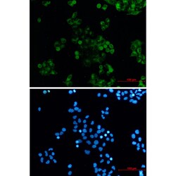 Invitrogen DAB2 Recombinant Rabbit Monoclonal Antibody (K01_2Q43) 100 &mu;L | Buy Online | Invitrogen&trade; | Fisher Scientific
