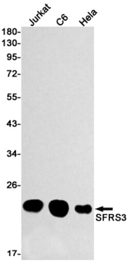 Invitrogen SRSF3 Recombinant Rabbit Monoclonal Antibody (K01_2Q45) 100 &mu;L | Buy Online | Invitrogen&trade; | Fisher Scientific