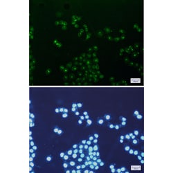Invitrogen TFAM Recombinant Rabbit Monoclonal Antibody (K01_2T84) 100 &mu;L | Buy Online | Invitrogen&trade; | Fisher Scientific