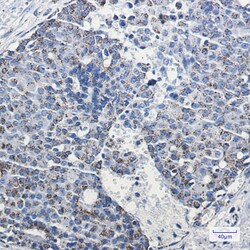 Invitrogen TFAM Recombinant Rabbit Monoclonal Antibody (K01_2T84) 100 &mu;L | Buy Online | Invitrogen&trade; | Fisher Scientific
