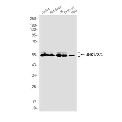 Invitrogen JNK1 Recombinant Rabbit Monoclonal Antibody (K01_2T92) 50 &mu;L | Buy Online | Invitrogen&trade; | Fisher Scientific