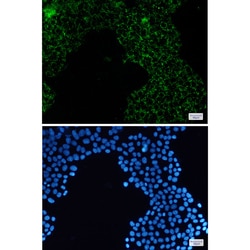 Invitrogen PDHA1 Recombinant Rabbit Monoclonal Antibody (K01_2U36) 100 &mu;L | Buy Online | Invitrogen&trade; | Fisher Scientific