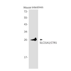 Invitrogen CTR1 Recombinant Rabbit Monoclonal Antibody (K01_2U57) 50 &mu;L | Buy Online | Invitrogen&trade; | Fisher Scientific