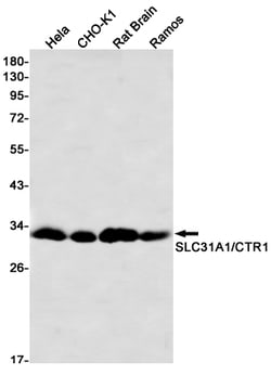 Invitrogen CTR1 Recombinant Rabbit Monoclonal Antibody (K01_2U57) 50 &mu;L | Buy Online | Invitrogen&trade; | Fisher Scientific