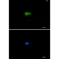 Invitrogen NAMPT Recombinant Rabbit Monoclonal Antibody (K01_2U61) 50 &mu;L | Buy Online | Invitrogen&trade; | Fisher Scientific