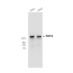 Invitrogen PRP8 Recombinant Rabbit Monoclonal Antibody (K01_3J76) 50 &mu;L | Buy Online | Invitrogen&trade; | Fisher Scientific