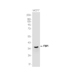 Invitrogen FBP1 Recombinant Rabbit Monoclonal Antibody (K01_3J78) 50 &mu;L | Buy Online | Invitrogen&trade; | Fisher Scientific