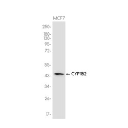 Invitrogen CYP11B2 Recombinant Rabbit Monoclonal Antibody (K01_3J89) 100 &mu;L | Buy Online | Invitrogen&trade; | Fisher Scientific