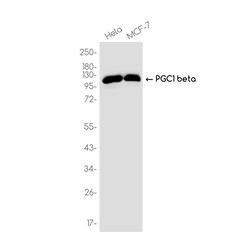 Invitrogen PPARGC1B Recombinant Rabbit Monoclonal Antibody (K01_3K02) 100 &mu;L | Buy Online | Invitrogen&trade; | Fisher Scientific