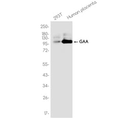Invitrogen GAA Recombinant Rabbit Monoclonal Antibody (K01_3K03) 50 &mu;L | Buy Online | Invitrogen&trade; | Fisher Scientific