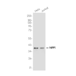 Invitrogen PPP1R8 Recombinant Rabbit Monoclonal Antibody (K01_3K23) 50 &mu;L | Buy Online | Invitrogen&trade; | Fisher Scientific