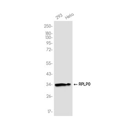 Invitrogen RPLP0 Recombinant Rabbit Monoclonal Antibody (K01_3K33) 100 &mu;L | Buy Online | Invitrogen&trade; | Fisher Scientific