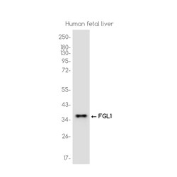 Invitrogen&trade;&nbsp;FGL1 Recombinant Rabbit Monoclonal Antibody (K01_3K38)