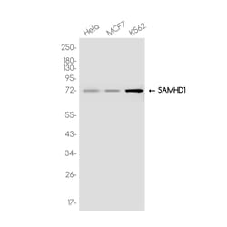 Invitrogen SAMHD1 Recombinant Rabbit Monoclonal Antibody (K01_3K39) 100 &mu;L | Buy Online | Invitrogen&trade; | Fisher Scientific