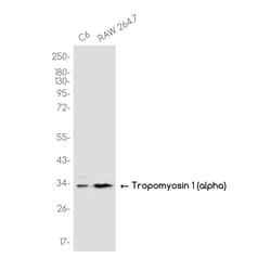 Invitrogen TPM1 Recombinant Rabbit Monoclonal Antibody (K01_3K52) 50 &mu;L | Buy Online | Invitrogen&trade; | Fisher Scientific