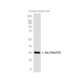 Invitrogen SULT2A1 Recombinant Rabbit Monoclonal Antibody (K01_3K55) 100 &mu;L | Buy Online | Invitrogen&trade; | Fisher Scientific
