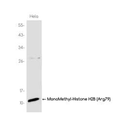 Invitrogen H2BR79me1 Recombinant Rabbit Monoclonal Antibody (K01_3K79) 50 &mu;L | Buy Online | Invitrogen&trade; | Fisher Scientific
