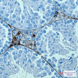 Invitrogen PRAME Recombinant Rabbit Monoclonal Antibody (K01_3K93) 50 &mu;L | Buy Online | Invitrogen&trade; | Fisher Scientific