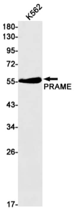 Invitrogen PRAME Recombinant Rabbit Monoclonal Antibody (K01_3K93) 50 &mu;L | Buy Online | Invitrogen&trade; | Fisher Scientific