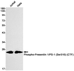 Invitrogen Phospho-Presenilin 1 (Ser310) Recombinant Rabbit Monoclonal Antibody (K01_3L08) 100 &mu;L | Buy Online | Invitrogen&trade; | Fisher Scientific
