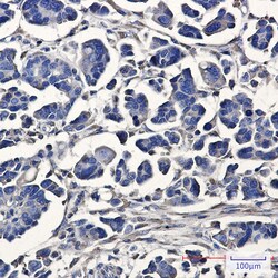 Invitrogen ATE1 Recombinant Rabbit Monoclonal Antibody (K01_3L14) 100 &mu;L | Buy Online | Invitrogen&trade; | Fisher Scientific