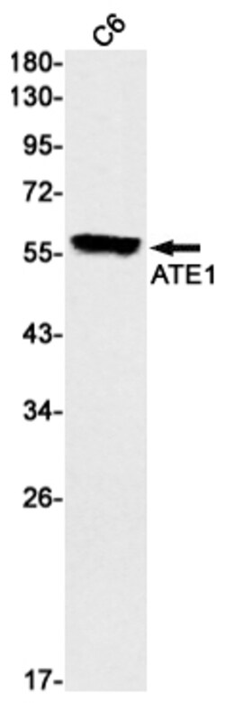 Invitrogen ATE1 Recombinant Rabbit Monoclonal Antibody (K01_3L14) 100 &mu;L | Buy Online | Invitrogen&trade; | Fisher Scientific