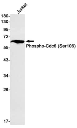 Invitrogen Phospho-Cdc6 (Ser106) Recombinant Rabbit Monoclonal Antibody (K01_3L22) 50 &mu;L | Buy Online | Invitrogen&trade; | Fisher Scientific