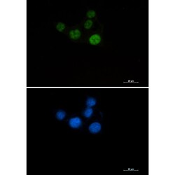 Invitrogen CHK2 Recombinant Rabbit Monoclonal Antibody (K01_3L23) 50 &mu;L | Buy Online | Invitrogen&trade; | Fisher Scientific