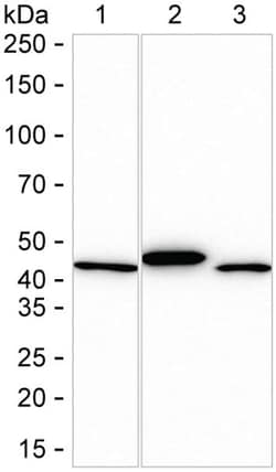 Invitrogen Creatine Kinase BB Recombinant Rabbit Monoclonal Antibody (K01_3L25) 100 &mu;L | Buy Online | Invitrogen&trade; | Fisher Scientific