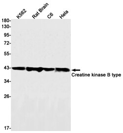 Invitrogen Creatine Kinase BB Recombinant Rabbit Monoclonal Antibody (K01_3L25) 100 &mu;L | Buy Online | Invitrogen&trade; | Fisher Scientific