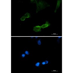 Invitrogen DCLK1 Recombinant Rabbit Monoclonal Antibody (K01_3L32) 100 &mu;L | Buy Online | Invitrogen&trade; | Fisher Scientific