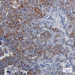 Invitrogen DCLK1 Recombinant Rabbit Monoclonal Antibody (K01_3L32) 100 &mu;L | Buy Online | Invitrogen&trade; | Fisher Scientific