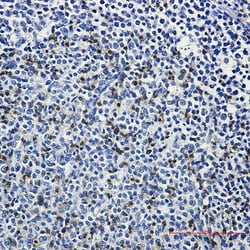 Invitrogen LAT Recombinant Rabbit Monoclonal Antibody (K01_3L46) 100 &mu;L | Buy Online | Invitrogen&trade; | Fisher Scientific