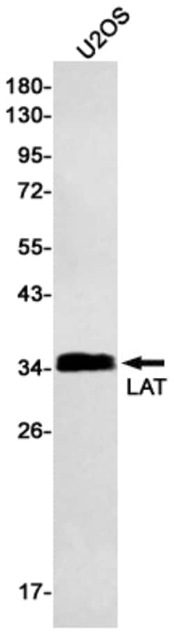 Invitrogen LAT Recombinant Rabbit Monoclonal Antibody (K01_3L46) 100 &mu;L | Buy Online | Invitrogen&trade; | Fisher Scientific