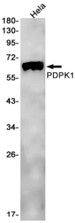 Invitrogen PDPK1 Recombinant Rabbit Monoclonal Antibody (K01_3L55) 50 &mu;L | Buy Online | Invitrogen&trade; | Fisher Scientific
