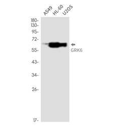 Invitrogen&trade;&nbsp;GRK6 Recombinant Rabbit Monoclonal Antibody (K01_3L85)