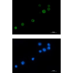 Invitrogen MCAK Recombinant Rabbit Monoclonal Antibody (K01_3L87) 50 &mu;L | Buy Online | Invitrogen&trade; | Fisher Scientific