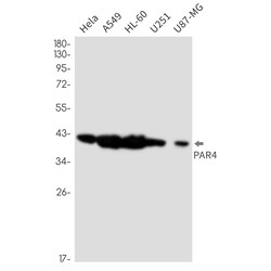 Invitrogen PAR4 Recombinant Rabbit Monoclonal Antibody (K01_3L90) 100 &mu;L | Buy Online | Invitrogen&trade; | Fisher Scientific