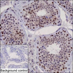 Invitrogen ANKRD26P1 Recombinant Mouse Monoclonal Antibody (K40073_16B3) 50 &mu;L | Buy Online | Invitrogen&trade; | Fisher Scientific