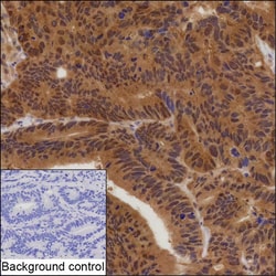 Invitrogen PDCD6 Recombinant Mouse Monoclonal Antibody (K92068_2D10) 50 &mu;L | Buy Online | Invitrogen&trade; | Fisher Scientific