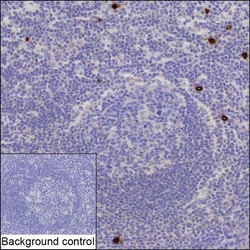 Invitrogen CD122 Recombinant Mouse Monoclonal Antibody (K9N023_10B12) 50 &mu;L | Buy Online | Invitrogen&trade; | Fisher Scientific