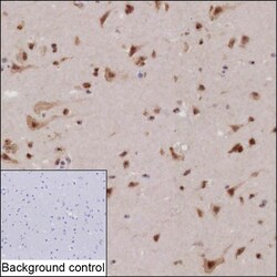 Invitrogen KIAA1755 Recombinant Mouse Monoclonal Antibody (K52071_6D12) 50 &mu;L | Buy Online | Invitrogen&trade; | Fisher Scientific