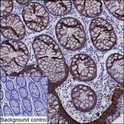 Invitrogen A33 Recombinant Mouse Monoclonal Antibody (K92070_5D9) 50 &mu;L | Buy Online | Invitrogen&trade; | Fisher Scientific