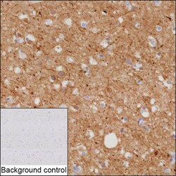 Invitrogen NF-M Recombinant Mouse Monoclonal Antibody (K1E065_3G3) 50 &mu;L | Buy Online | Invitrogen&trade; | Fisher Scientific