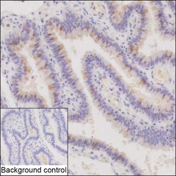 Invitrogen C22orf15 Recombinant Mouse Monoclonal Antibody (K9N021_14D4) 50 &mu;L | Buy Online | Invitrogen&trade; | Fisher Scientific