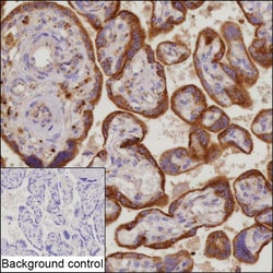 Invitrogen CLN2 Recombinant Mouse Monoclonal Antibody (K1H013_12G7) 50 &mu;L | Buy Online | Invitrogen&trade; | Fisher Scientific