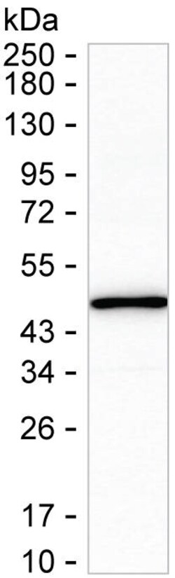 Invitrogen CLN2 Recombinant Mouse Monoclonal Antibody (K1H013_12G7) 50 &mu;L | Buy Online | Invitrogen&trade; | Fisher Scientific