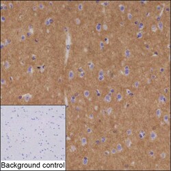 Invitrogen ADAM22 Recombinant Mouse Monoclonal Antibody (K40080_20C9) 50 &mu;L | Buy Online | Invitrogen&trade; | Fisher Scientific