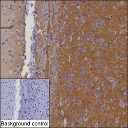 Invitrogen ADAM22 Recombinant Mouse Monoclonal Antibody (K40080_20C9) 50 &mu;L | Buy Online | Invitrogen&trade; | Fisher Scientific