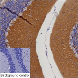 Invitrogen ADAM22 Recombinant Mouse Monoclonal Antibody (K40080_20C9) 50 &mu;L | Buy Online | Invitrogen&trade; | Fisher Scientific